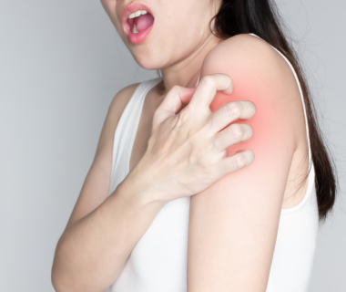 Scabbia: come si prende e come evitare il contagio